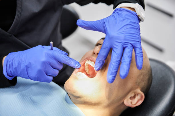 Emergency Dental Filling Replacement in NC